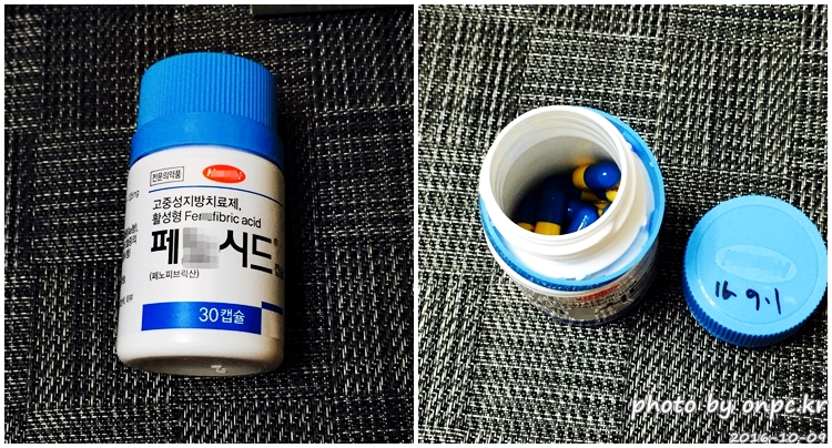 저탄수화물 고지방(LCHF) 식단 및 후기 - 시원한 맥주와 코스트코에서 구입한 연어 & 광어 회 저탄수화물 고지방(LCHF) 식단 및 후기