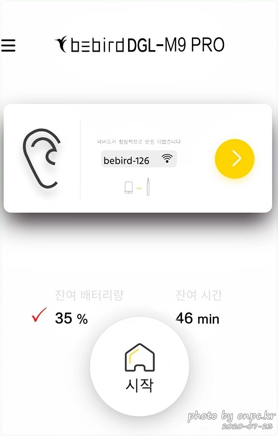 샤오미 비버드 스마트 내시경 귀이개(Bebird M9 Pro)